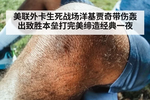 美联外卡生死战场洋基贾奇带伤轰出致胜本垒打完美缔造经典一夜
